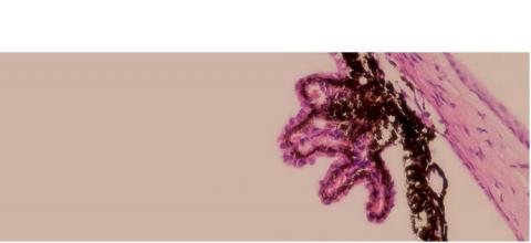 coupe histologique du corps ciliaire