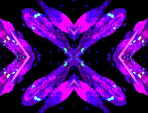 Peau et follicules pileux de souris, présentant des lésions de l'ADN -en vert- dans l'épithélium de la peau- Cellules souches du follicule pileux -en violet-