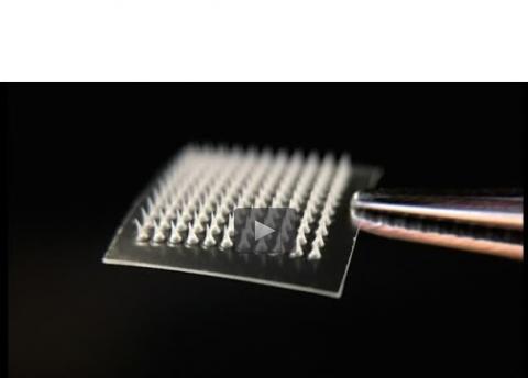 Une alternative prometteuse à la liposuccion