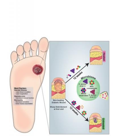 D'autres bactéries retrouvées couramment sur ces plaies peuvent soit altérer, soit améliorer le processus de cicatrisation
