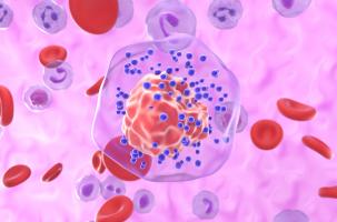 Cette étude suggère de nouvelles options thérapeutiques permettant de bloquer l'accumulation d'acides gras et les signaux immunosuppresseurs associés (Visuel Adobe Stock 1031587846) Cette étude suggère de nouvelles options thérapeutiques permettant de bloquer l'accumulation d'acides gras et les signaux immunosuppresseurs associés (Visuel Adobe Stock 1031587846)