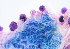 Ce lien moléculaire entre les polluants atmosphériques et un risque accru de démence à corps de Lewy  met à nouveau en exergue les effets délétères des particules fines (PM2,5) (Visuel Adobe Stock 1078672973)