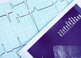 Suivre le régime DASH (Dietary Approaches to Stop Hypertension) connu pour ses bénéfices contre l’hypertension, peut également et considérablement réduire et prévenir le risque d'insuffisance cardiaque, chez les moins de 75 ans