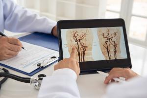 L'inversion des altérations des lipoprotéines chez les patients victimes d'un AVC ischémique ouvre peut-être de nouvelles perspectives thérapeutiques dans la gestion des maladies cardiovasculaires (Visuel Adobe Stock 1106737954) L'inversion des altérations des lipoprotéines chez les patients victimes d'un AVC ischémique ouvre peut-être de nouvelles perspectives thérapeutiques dans la gestion des maladies cardiovasculaires (Visuel Adobe Stock 1106737954)