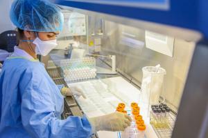 Mycobacterium tuberculosis (Mtb), la bactérie responsable de la tuberculose (TB), est présente dans l'air expiré par 90 % des personnes suspectées d’avoir la maladie (Visuel Adobe Stock 112984573) Mycobacterium tuberculosis (Mtb), la bactérie responsable de la tuberculose (TB), est présente dans l'air expiré par 90 % des personnes suspectées d’avoir la maladie (Visuel Adobe Stock 112984573)