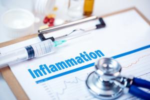 On sait que l’inflammation est la première étape, normale et naturelle de la réponse immunitaire, on connait moins bien le mécanisme qui y met fin (Visuel Adobe Stock 136261201) On sait que l’inflammation est la première étape, normale et naturelle de la réponse immunitaire, on connait moins bien le mécanisme qui y met fin (Visuel Adobe Stock 136261201)
