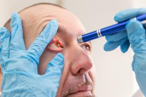 L'étude documente une toute nouvelle alternative thérapeutique pour les maladies oculaires inflammatoires : les injections de cellules souches (Visuel Adobe Stock 138202387)