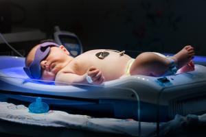 Un bébé sur 8 est génétiquement protégé contre la jaunisse ou ictère du nouveau-né (Visuel Adobe Stock 143179458) Un bébé sur 8 est génétiquement protégé contre la jaunisse ou ictère du nouveau-né (Visuel Adobe Stock 143179458)