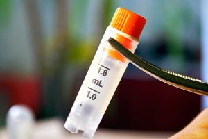 Oui, les suppléments à base de fécule de pomme de terre pourraient être une solution contre les complications des greffes de moelle osseuse (Visuel Adobe Stock 143338323) Oui, les suppléments à base de fécule de pomme de terre pourraient être une solution contre les complications des greffes de moelle osseuse (Visuel Adobe Stock 143338323)