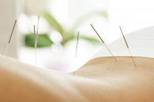 L'acupuncture peut-elle contribuer à réduire les bouffées de chaleur et autres effets secondaires du traitement antihormonal du cancer du sein ? (Visuel Adobe Stock 166030227) L'acupuncture peut-elle contribuer à réduire les bouffées de chaleur et autres effets secondaires du traitement antihormonal du cancer du sein ? (Visuel Adobe Stock 166030227)