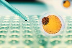 Comprendre les mécanismes cellulaires de l’inflammation et du dysfonctionnement métabolique induits par l’obésité (Visuel Adobe Stock 185077367)