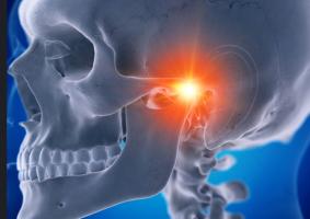 L’arthrose n’épargne pas l'articulation temporo mandibulaire et cette arthrose de la mâchoire est fréquente à la suite d'un traumatisme ou d'un déplacement discal (Visuel Adobe Stock 224170533) L’arthrose n’épargne pas l'articulation temporo mandibulaire et cette arthrose de la mâchoire est fréquente à la suite d'un traumatisme ou d'un déplacement discal (Visuel Adobe Stock 224170533)