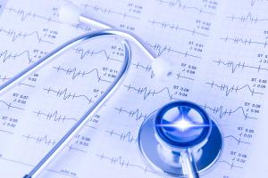 La radiothérapie reprogramme les cellules du muscle cardiaque à un état plus jeune et peut ainsi gommer les irrégularités de rythme chez les personnes atteintes d'arythmie cardiaque (Visuel Adobe Stock 229601539)