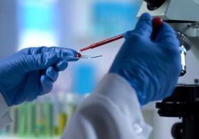 Un test sanguin, qualifié de révolutionnaire, permet de diagnostiquer l'encéphalomyélite myalgique (ME) ou fatigue chronique (CFS : Chronic Fatigue Syndrome), une maladie encore négligée, mal détectée et difficile à diagnostiquée car partageant de nombreux symptômes avec d’autres pathologies (Visuel Adobe Stock 233950564) Un test sanguin, qualifié de révolutionnaire, permet de diagnostiquer l'encéphalomyélite myalgique (ME) ou fatigue chronique (CFS : Chronic Fatigue Syndrome), une maladie encore négligée, mal détectée et difficile à diagnostiquée car partageant de nombreux symptômes avec d’autres pathologies (Visuel Adobe Stock 233950564)