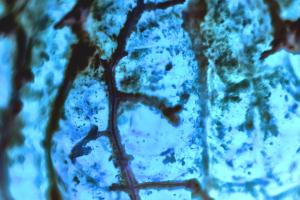 Améliorer la précision du diagnostic du mélanome à l’aide de nouvelles techniques d'imagerie qui apportent des informations moléculaires sur l'écosystème tumoral et permettent ainsi de mieux caractériser la tumeur (Visuel Adobe Stock 251419242). Améliorer la précision du diagnostic du mélanome à l’aide de nouvelles techniques d'imagerie qui apportent des informations moléculaires sur l'écosystème tumoral et permettent ainsi de mieux caractériser la tumeur (Visuel Adobe Stock 251419242).