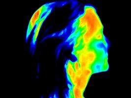 C’est une nouvelle application de l’intelligence artificielle dans le diagnostic, ici combinée à l'imagerie thermique faciale (Visuel Adobe Stock 252475008)