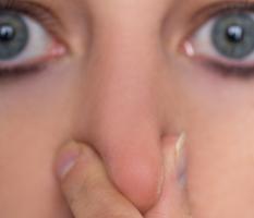 La perte d'odorat est signalée par les patients dans 86% des cas légers de COVID-19 (Visuel Adobe Stock 257463391) La perte d'odorat est signalée par les patients dans 86% des cas légers de COVID-19 (Visuel Adobe Stock 257463391)