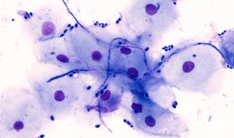 En décryptant ce processus dans la relation complexe entre les humains et les champignons du microbiote, cette étude désigne de nouvelles cibles qui pourraient aider à lutter contre l’émergence croissante d'agents pathogènes résistants aux médicaments (Visuel Adobe Stock 275831019) En décryptant ce processus dans la relation complexe entre les humains et les champignons du microbiote, cette étude désigne de nouvelles cibles qui pourraient aider à lutter contre l’émergence croissante d'agents pathogènes résistants aux médicaments (Visuel Adobe Stock 275831019)