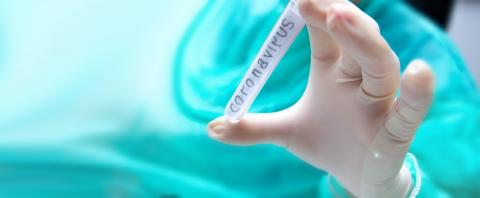 Les personnes sans symptômes peuvent-elle infecter les autres ? Les personnes sans symptômes peuvent-elle infecter les autres ?