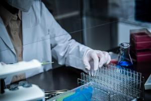 Ce nouveau test de dépistage prometteur de l'hépatite C est rapide et réalisable au chevet du patient (Visuel Adobe Stock 367695694) Ce nouveau test de dépistage prometteur de l'hépatite C est rapide et réalisable au chevet du patient (Visuel Adobe Stock 367695694)