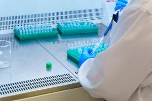 C’est un cas clinique, celui d’une patiente âgée de 90 ans diagnostiquée positive à 2 variants différents du SARS-CoV-2 (Visuel Adobe Stock 388806993) C’est un cas clinique, celui d’une patiente âgée de 90 ans diagnostiquée positive à 2 variants différents du SARS-CoV-2 (Visuel Adobe Stock 388806993)