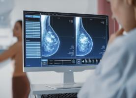 Les femmes qui manquent leur première mammographie présentent un risque accru de décès par cancer du sein (Visuel Adobe Stock 422714239)