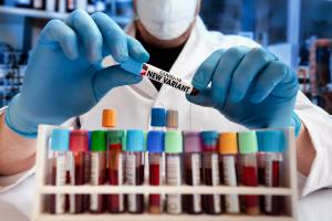 Une capacité d’échappement immunitaire significative du nouveau variant Omicron, c’est ce que soutient cette étude de virologues experts  (Visuel Adobe Stock 423691758)