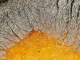 En désignant les cellules gliales telle une nouvelle cible, ces travaux suggèrent de «réparer» les cellules de soutien défectueuses plutôt que de « remplacer » les neurones perdus dans la maladie (Visuel Adobe Stock 490381963) En désignant les cellules gliales telle une nouvelle cible, ces travaux suggèrent de «réparer» les cellules de soutien défectueuses plutôt que de « remplacer » les neurones perdus dans la maladie (Visuel Adobe Stock 490381963).