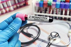 Ces scientifiques viennent de détecter détectent le virus monkeypox dans les testicules de survivants de primates non humains (Visuel Adobe Stock 506616350) Ces scientifiques viennent de détecter détectent le virus monkeypox dans les testicules de survivants de primates non humains (Visuel Adobe Stock 506616350)