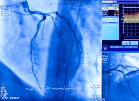 Pourquoi l’avantage du médicament va bien au-delà du simple report de l'intervention chirurgicale (Visuel Adobe Stock 527681350) Pourquoi l’avantage du médicament va bien au-delà du simple report de l'intervention chirurgicale (Visuel Adobe Stock 527681350)