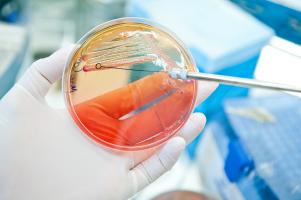 Si la plupart des souches E. coli sont inoffensives, les infections à d’autres souches E. coli multirésistantes entraînent environ 800.000 décès dans le monde chaque année (Visuel Adobe Stock 55246874) Si la plupart des souches E. coli sont inoffensives, les infections à d’autres souches E. coli multirésistantes entraînent environ 800.000 décès dans le monde chaque année (Visuel Adobe Stock 55246874)