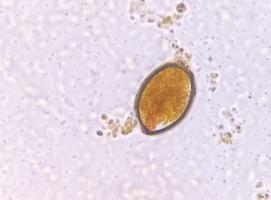 Cette bactérie intestinale pourrait être la cé d'une bonne santé cardiométabolique et globale (Visuel Adobe Stock 564119731) Cette bactérie intestinale pourrait être la cé d'une bonne santé cardiométabolique et globale (Visuel Adobe Stock 564119731)