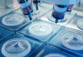 Ces travaux, publiés dans le Lancet, qui aboutissent à un mouveau traitement disposible en clinique dans 5 hôpitaux américains, ouvrent un immense espoir pour les patients et leurs familles (Visuel Adobe Stock 730832935) Ces travaux, publiés dans le Lancet, qui aboutissent à un mouveau traitement disposible en clinique dans 5 hôpitaux américains, ouvrent un immense espoir pour les patients et leurs familles (Visuel Adobe Stock 730832935)