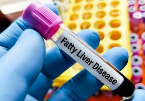 L'étude alerte sur le risque particulièrement élevé de ces patients diabétiques qui souffrent aussi d’obésité, de développer une maladie hépatique plus grave (Visuel Adobe Stock 764582361)