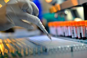 C'est l'espoir d'un nouveau traitement possible pour les cœurs défaillants : une protéine clé susceptible d'aider les patients cardiaques (Visuel Adobe Stock 832554796)