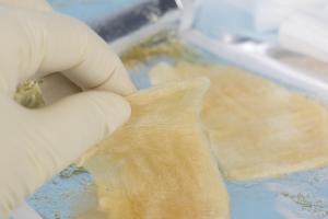 Il s'agit un hydrogel multiforme à base de nanofibres de cellulose capables d’encapsuler et de délivrer des cellules toutes neuves.