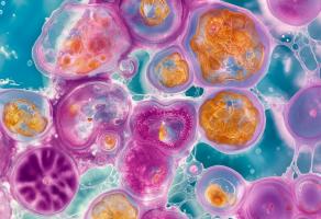 Lorsqu’il s’agit de notre propre muscle, ce marbrage est plutôt un signe de mauvaise santé (Visuel Adobe Stock 882299305)