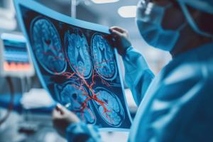 Les neurologues devraient-ils systématiquement prendre en compte les facteurs hormonaux lors de l’évaluation et du traitement de leurs patients ? (Visuel Adobe Stock 915110411)