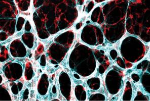 Qu'est-ce qui fait grossir les vaisseaux sanguins ? (Visuel Michael Potente, MDC) Qu'est-ce qui fait grossir les vaisseaux sanguins ? (Visuel Michael Potente, MDC)