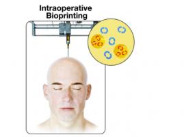 La réparation et la cicatrisation osseuses peuvent être considérablement améliorées si l’on inclut dans la thérapie les gènes qui codent pour les facteurs de croissance (Visuel Dong Heo, Kyung Hee University; Ozbolat Lab, Penn State) La réparation et la cicatrisation osseuses peuvent être considérablement améliorées si l’on inclut dans la thérapie les gènes qui codent pour les facteurs de croissance (Visuel Dong Heo, Kyung Hee University; Ozbolat Lab, Penn State)