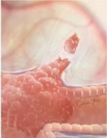 Lorsque les cellules quittent la tumeur primaire, elles ne répondent souvent plus aux médicaments qui ont initialement fonctionné (Visuel Fotolia) Lorsque les cellules quittent la tumeur primaire, elles ne répondent souvent plus aux médicaments qui ont initialement fonctionné (Visuel Fotolia)