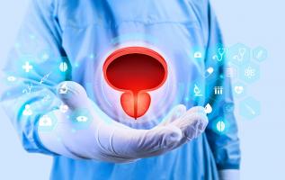 Traiter l'excès de cholestérol pour arrêter la croissance des cellules cancéreuses de la vessie apparaît comme une stratégie prometteuse (Visuel Adobe Stock 582325872) Traiter l'excès de cholestérol pour arrêter la croissance des cellules cancéreuses de la vessie apparaît comme une stratégie prometteuse (Visuel Adobe Stock 582325872)
