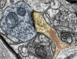 Image de microscopie électronique de cellules cérébrales avec épines dendritiques (jaune), appareil vertébral (rouge) et extrêmités des synapses (bleu) (Visuel Andreas Vlachos) Image de microscopie électronique de cellules cérébrales avec épines dendritiques (jaune), appareil vertébral (rouge) et extrêmités des synapses (bleu) (Visuel Andreas Vlachos)