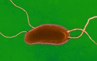 V. cholera (Institut Pasteur) V. cholera (Institut Pasteur)