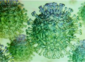 Ce n'est pas un hasard si certaines des épidémies virales les plus mortelles, dont les infections aux SRAS, MERS, Ebola, Marburg et probablement au nouveau virus 2019-nCoV prennent leurs sources chez la chauve-souris ou partagent de grandes similarités avec des virus hébergés par les chauves-souris. Ce n'est pas un hasard si certaines des épidémies virales les plus mortelles, dont les infections aux SRAS, MERS, Ebola, Marburg et probablement au nouveau virus 2019-nCoV prennent leurs sources chez la chauve-souris ou partagent de grandes similarités avec des virus hébergés par les chauves-souris.