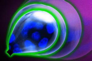 La plupart des tumeurs sont enveloppées dans une membrane basale protectrice qui maintient les cellules cancéreuses en place au fur et à mesure qu'elles se développent et se divisent (Visuel Jose-Luis Olivares, MIT) La plupart des tumeurs sont enveloppées dans une membrane basale protectrice qui maintient les cellules cancéreuses en place au fur et à mesure qu'elles se développent et se divisent (Visuel Jose-Luis Olivares, MIT)