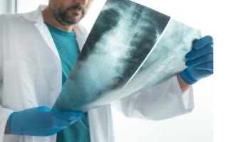 Il s'agit d'une approche révolutionnaire et non invasive basée sur l’utilisation de vésicules extracellulaires et l’outil d’édition du génome CRISPR. En synthèse, une thérapie régénérative, par injection, qui permettrait de reconstruire le disque (Visuel Fotolia 204537701) Il s'agit d'une approche révolutionnaire et non invasive basée sur l’utilisation de vésicules extracellulaires et l’outil d’édition du génome CRISPR. En synthèse, une thérapie régénérative, par injection, qui permettrait de reconstruire le disque (Visuel Fotolia 204537701)