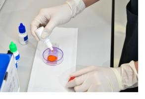 Le lycopène peut être trouvé dans certains fruits et légumes, mais sa principale source alimentaire est la tomate. Le lycopène peut être trouvé dans certains fruits et légumes, mais sa principale source alimentaire est la tomate.