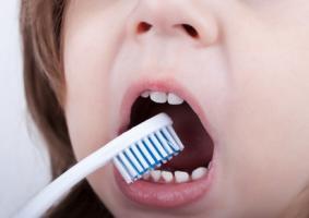 Le symptôme des « dents crayeuses » est caractérisé par une hypominéralisation et un défaut du développement de l'émail dentaire. Le symptôme des « dents crayeuses » est caractérisé par une hypominéralisation et un défaut du développement de l'émail dentaire.