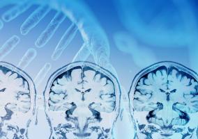 L'hyperactivité dans une région cérébrale spécifique pourrait être à l'origine des comportements associés au TSA (Visuel Adobe Stock 241817004) L'hyperactivité dans une région cérébrale spécifique pourrait être à l'origine des comportements associés au TSA (Visuel Adobe Stock 241817004)